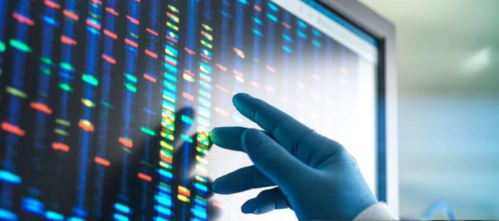 HSD & hEDS New Diagnostic Criteria and Classification Frameworks